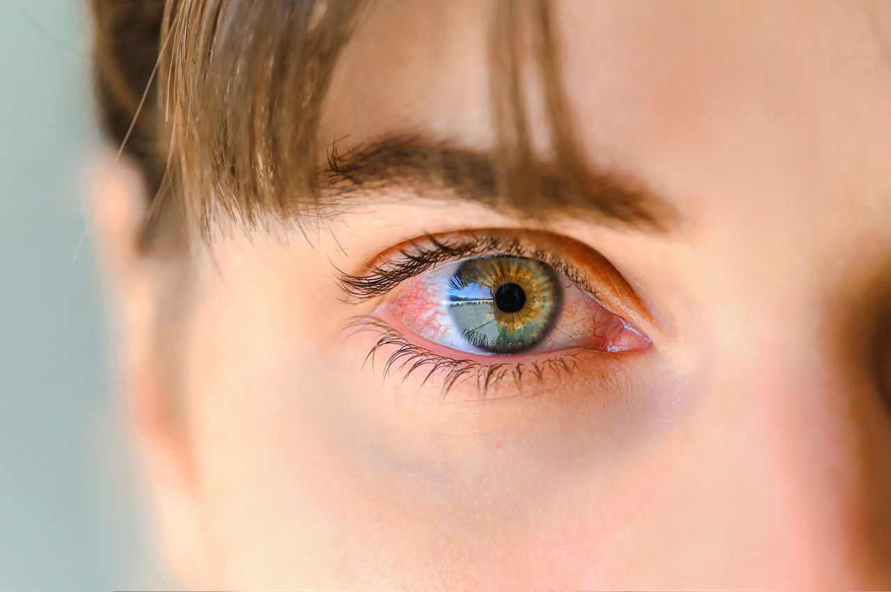 red eye